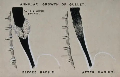 Radium